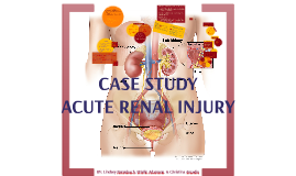 15%OFF Acute Kidney Failure Case Study Who can i get to help me write a college essay. Buy custom written