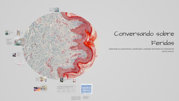 Conversando sobre Feridas by DENILSON DE S SILVA on Prezi