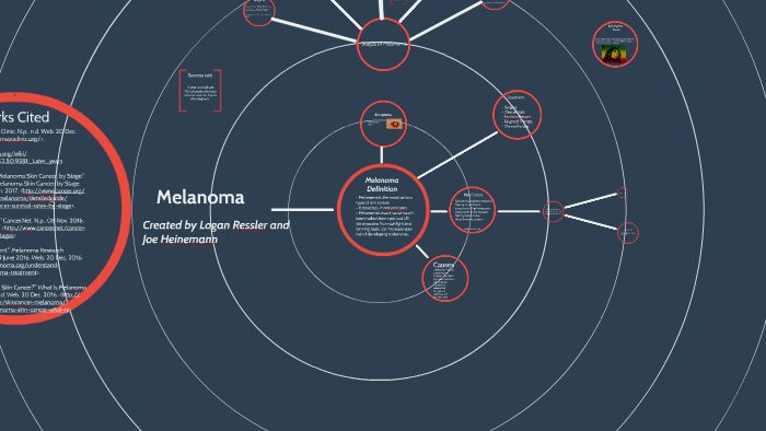 Melanoma (Skin cancer) by Logan Ressler