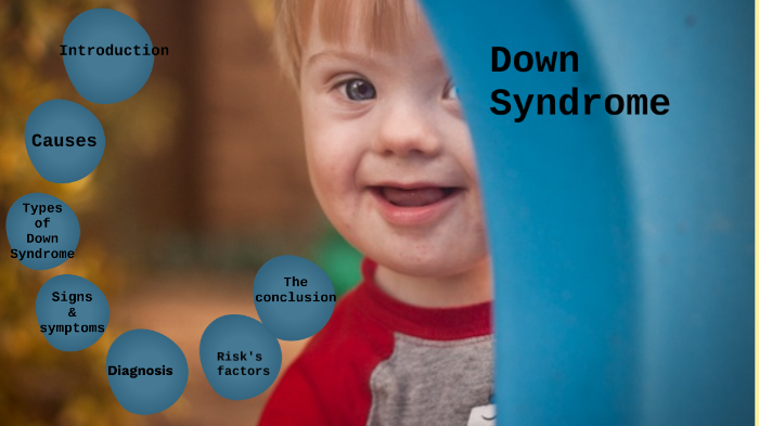 carol-Down Syndrome by carolina kh