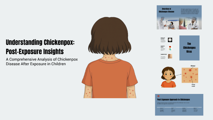 Understanding Chickenpox (Post-Exposure Insights) by Gh l 75 on Prezi