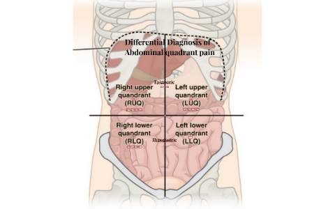 Surgery: Abdominal Quadrants by Melindi Brink on Prezi