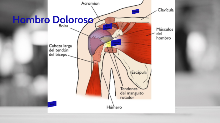 Hombro Doloroso HOMBRO DOLOROSO By Diana Montealegre On Prezi