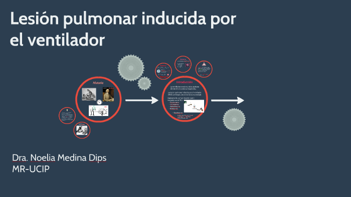 Lesión pulmonar inducida por ventilador by Natalia Medina on Prezi