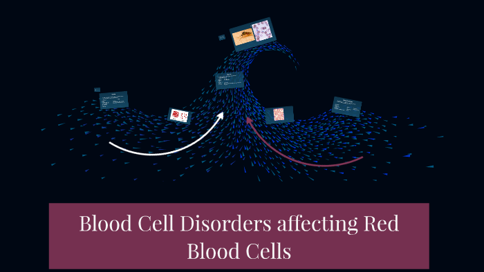 Blood Cell Disorders affecting Red Blood Cells by Destiny Pettway on Prezi