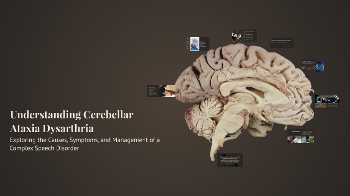 Understanding Cerebellar Ataxia Dysarthria by Андрей Бердникович on Prezi
