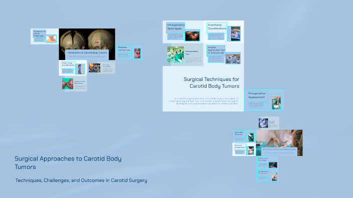 Surgical Approaches to Carotid Body Tumors by Alyaman Mohammad on Prezi