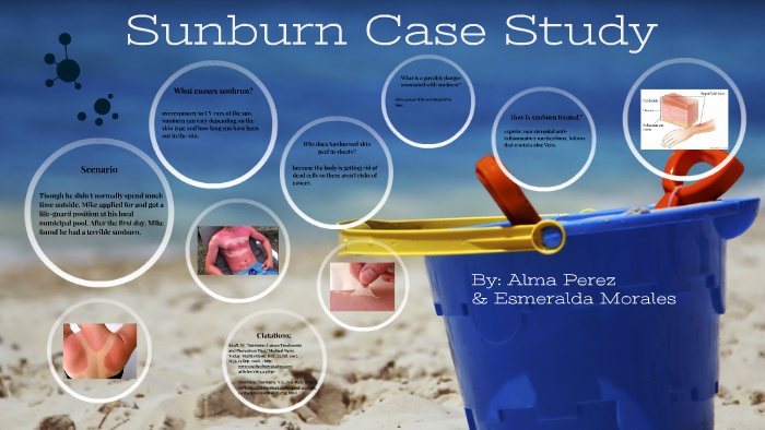 Sunburn Case Study by esme breton on Prezi
