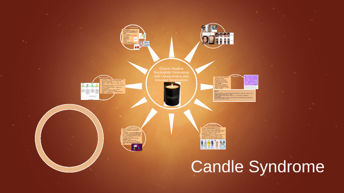 Candle Syndrome by Benita Ashu on Prezi