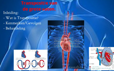 Transpositie van de grote vaten. by Matthijs van Groenendael on Prezi