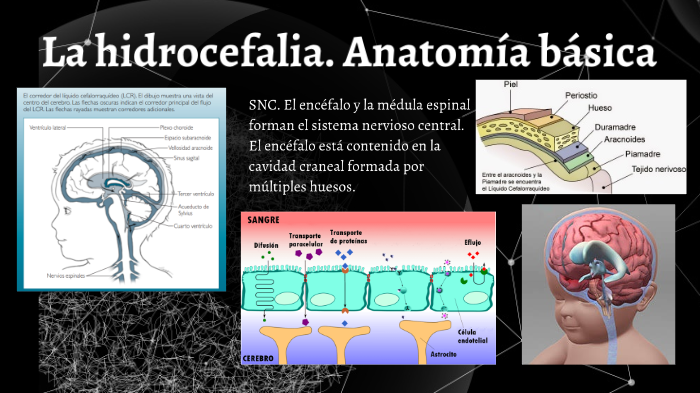 Bioquímica En La Hidrocefalia By Mo Anduaga On Prezi 0311