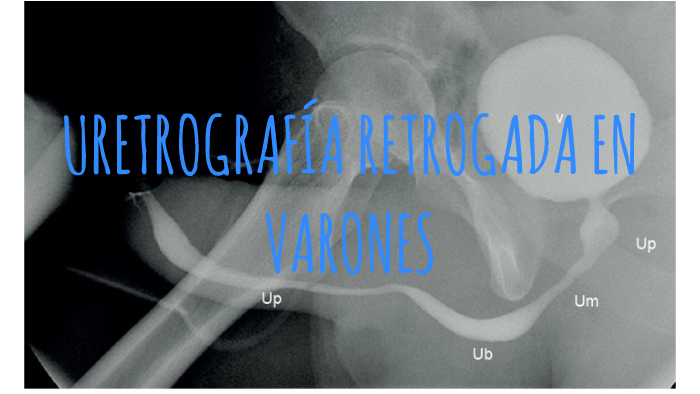 Uretrografía retrógrada en varones by Rosa Dos on Prezi