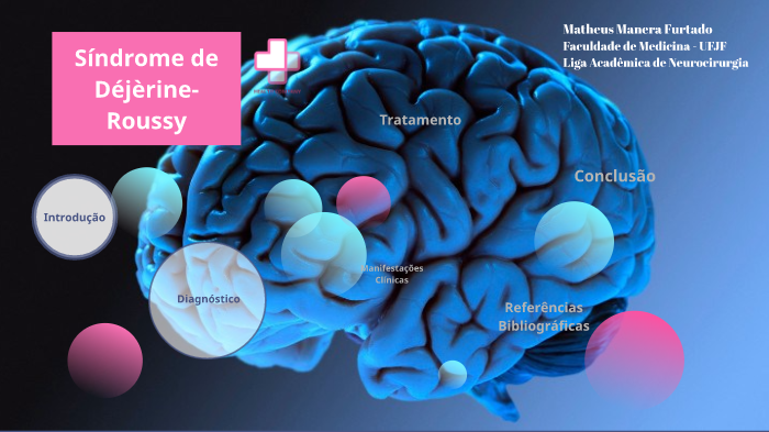 Síndrome de Déjèrine-Roussy by Matheus Manera Furtado on Prezi Next