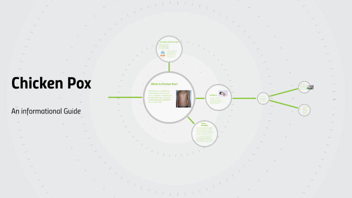Chicken Pox by Cole Hanck on Prezi