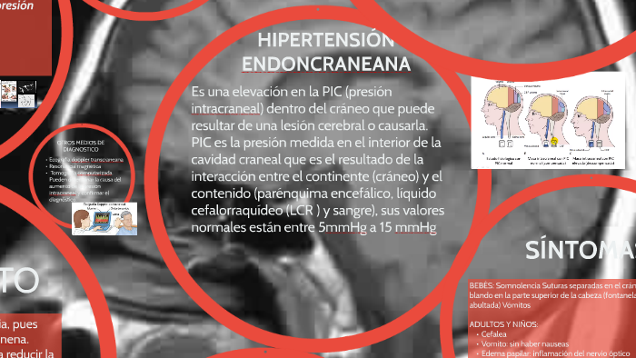 Signos de hipertensión intracraneal en bebés