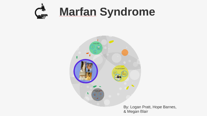 Marfan Syndrome by Logan Pratt