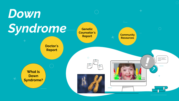 what new research should be done about down syndrome