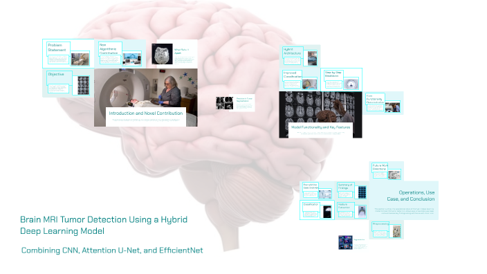 Brain MRI Tumor Detection Using a Hybrid Deep Learning Model by Anupam ...