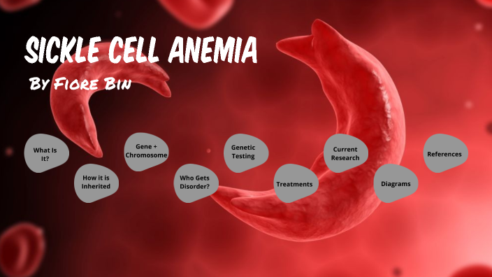 Sickle Cell Anemia by Fiore Bin on Prezi