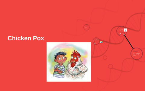 Chicken Pox by kailee noah on Prezi