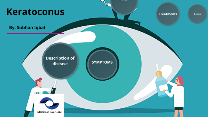 Keratoconus by Alltive