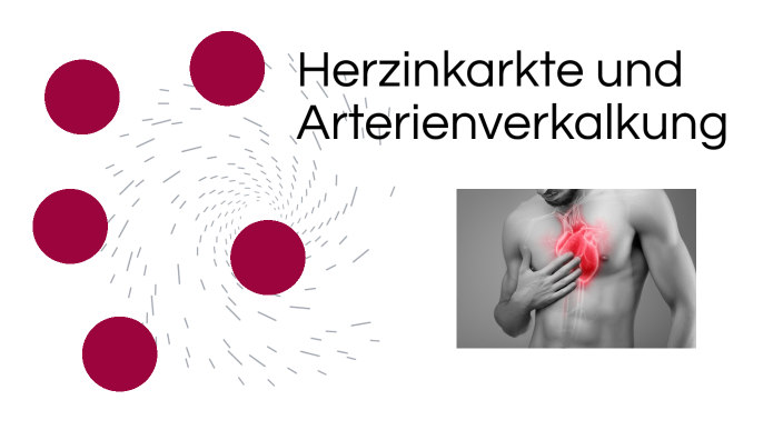 Herzinfarkte und Arterienverkalkung by paul fly on Prezi