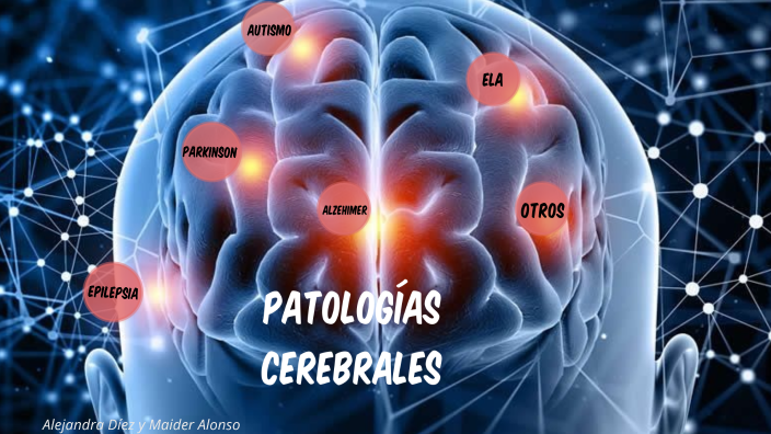 patologías cerebrales by Alejandra Diez Perez on Prezi