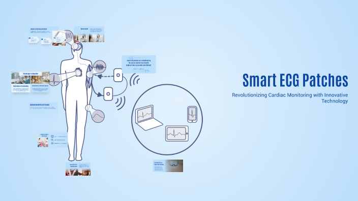 Smart ECG Patches by SY_A_53_REVATI AUTE on Prezi