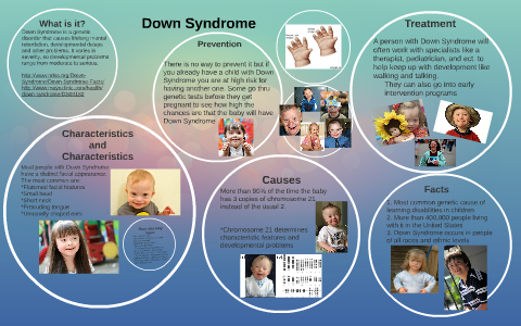 Down syndrome: Causes, characteristics, is it genetic, and more