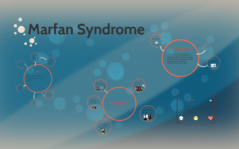 Marfan Syndrome by Kendall Mayo on Prezi