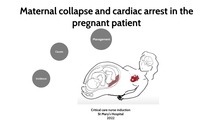 Maternal Collapse And Cardiac Arrest In The Pregnant Patient By Mohamed Alaa On Prezi 