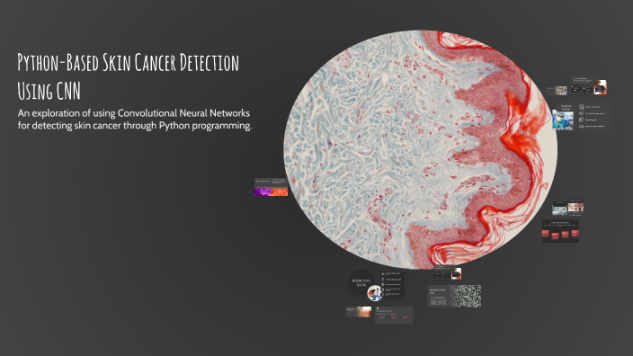 Python-Based Skin Cancer Detection Using CNN by Lucas Tivani on Prezi