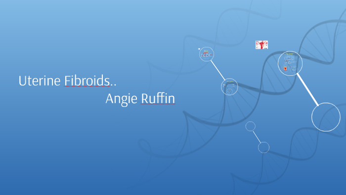 Uterine Fibroids.. by Angie Ruffin on Prezi