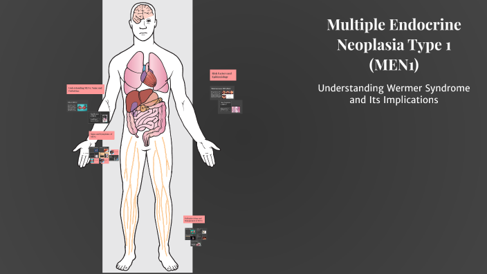 Multiple Endocrine Multiple Endocrine Neoplasia Type 1 (MEN1) by Mohammed Elamin Ramadan ...