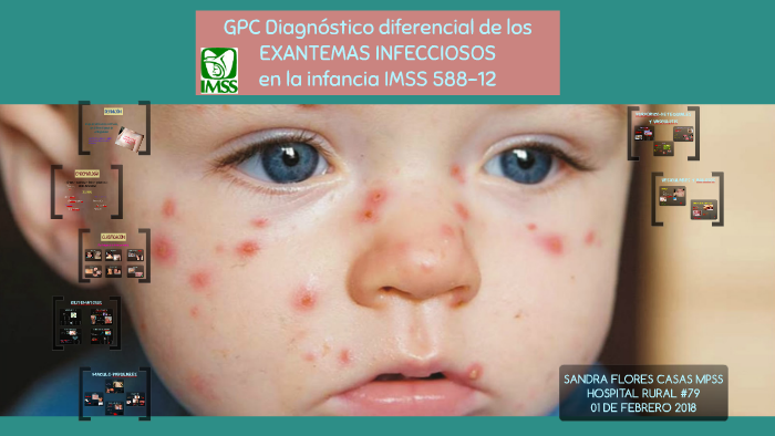 GPC DX DIFERENCIAL DE EXANTEMAS EN LA INFANCIA by Sandra Flores C on Prezi