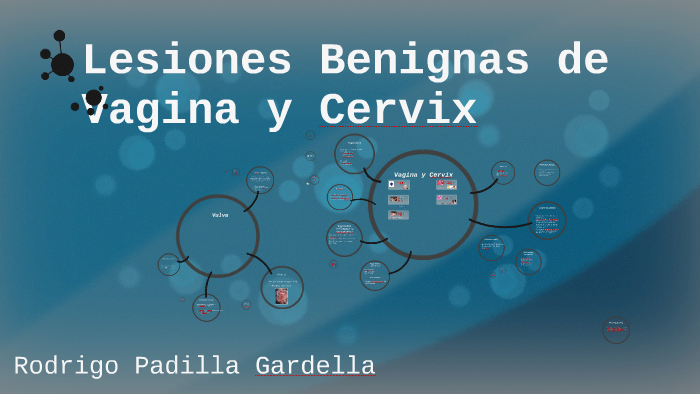 Lesiones Benignas De Vagina Y Cervix By Rodrigo Padilla Gardela On Prezi 4668