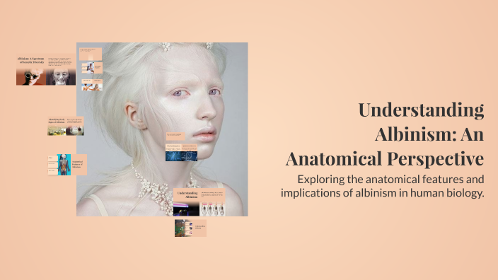 Understanding Albinism: An Anatomical Perspective by Maya on Prezi
