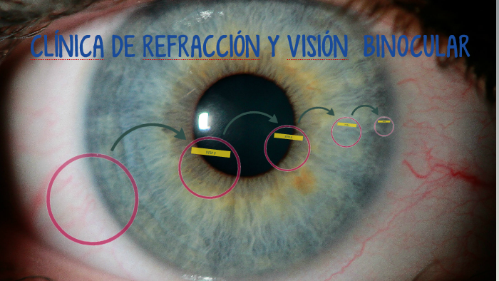 CLINICA DE REFRACCION Y VISION BINOCULAR by Eduard Rodriguez