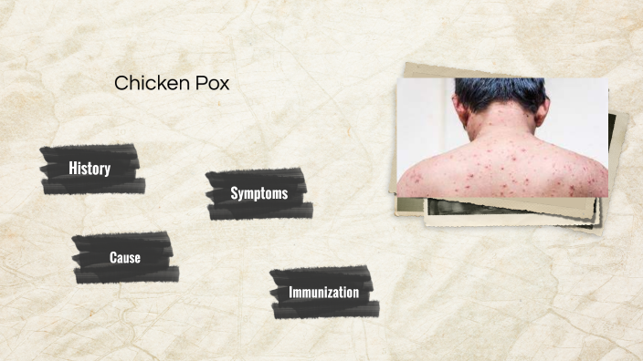 chicken pox by Mary Acheampong on Prezi