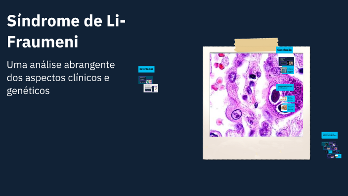 Síndrome de Li-Fraumeni by Diogo Mendes on Prezi