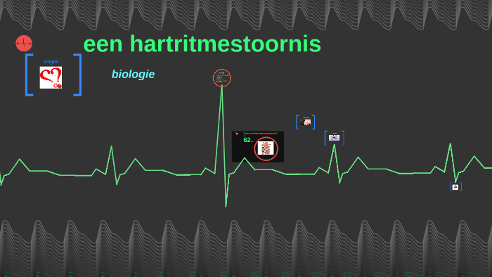 een hartritmestoornis by