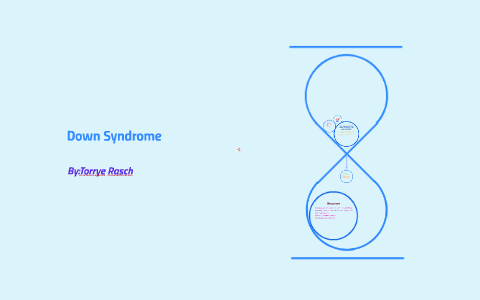 Down Syndrome by Torrye Rasch on Prezi