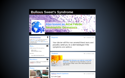 Bullous Sweet's Syndrome by Uprooted Rhino on Prezi