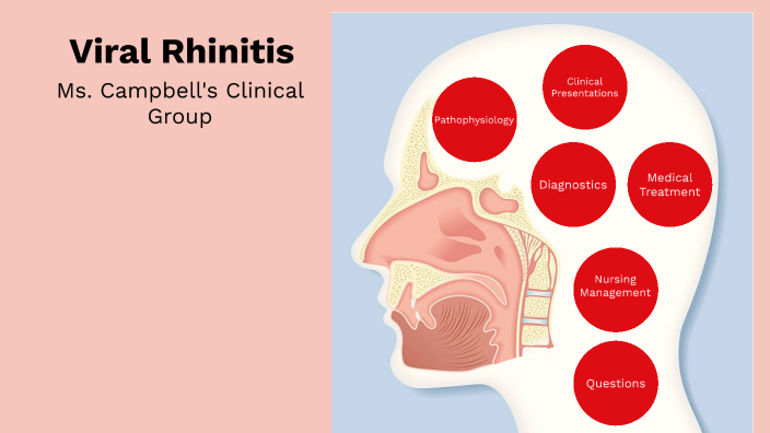 Viral Rhinitis by ambrosia davis on Prezi