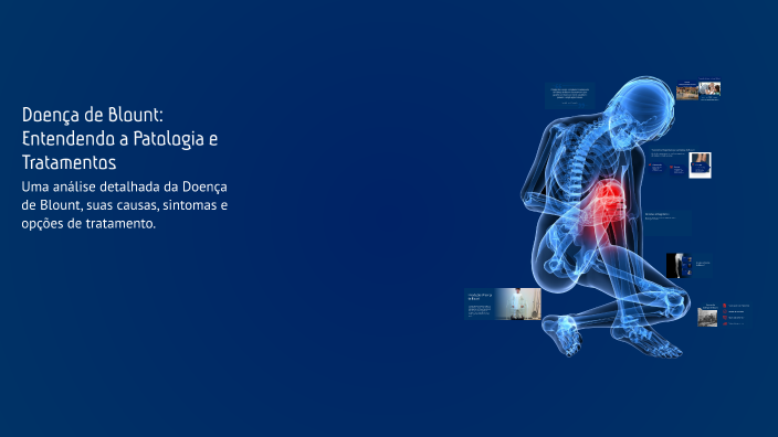 Doença de Blount: Entendendo a Patologia e Tratamentos by Patrine dos ...