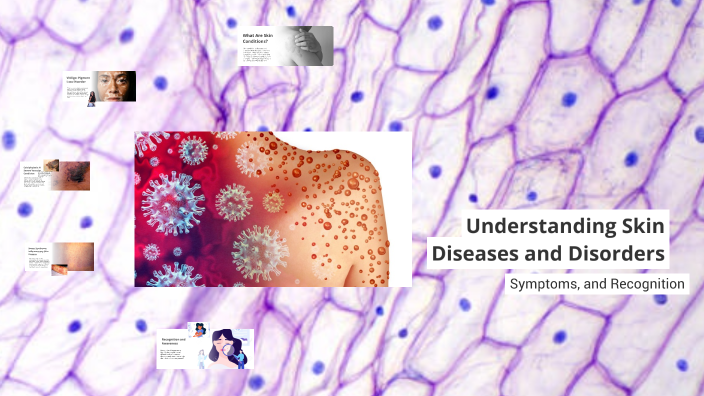 Understanding Diverse Skin Conditions by Alexis Rivard on Prezi