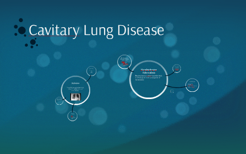 Cavitary Lung Disease by Danielle Canter