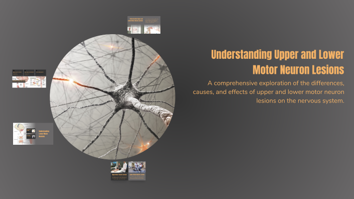 Understanding Upper and Lower Motor Neuron Lesions by mai ismail on Prezi