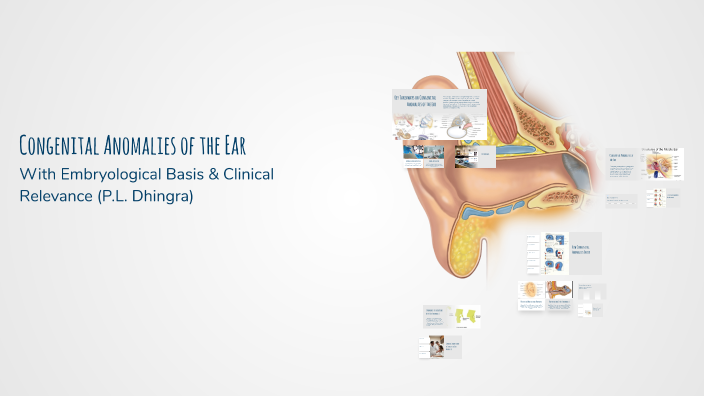 Congenital Anomalies of the Ear by Dev Tyagi on Prezi