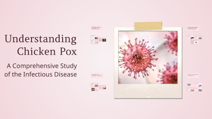 Understanding Chicken Pox by Davion Sims on Prezi